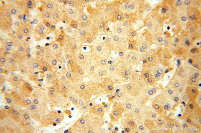 ATP5I Antibody in Immunohistochemistry (Paraffin) (IHC (P))