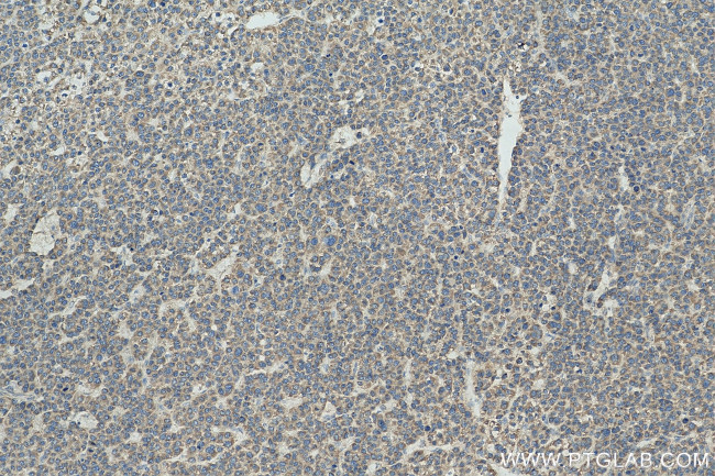 ATP5I Antibody in Immunohistochemistry (Paraffin) (IHC (P))