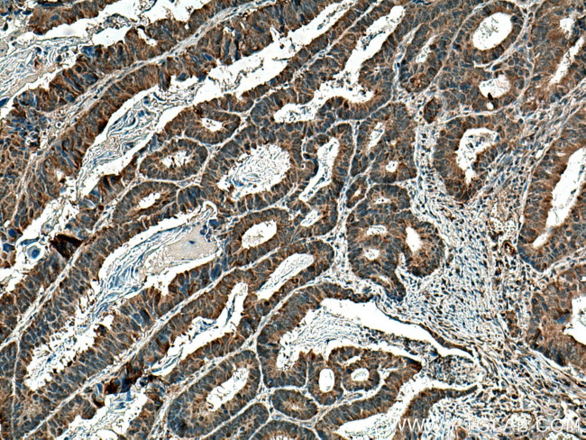 CDC25C Antibody in Immunohistochemistry (Paraffin) (IHC (P))