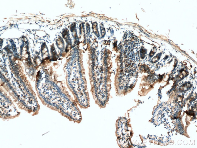 Villin Antibody in Immunohistochemistry (Paraffin) (IHC (P))