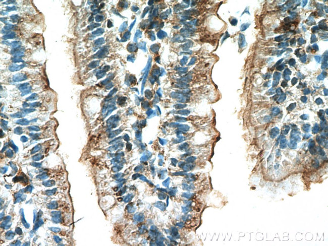 Villin Antibody in Immunohistochemistry (Paraffin) (IHC (P))