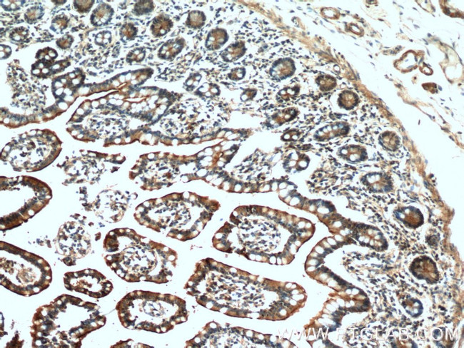 Villin Antibody in Immunohistochemistry (Paraffin) (IHC (P))