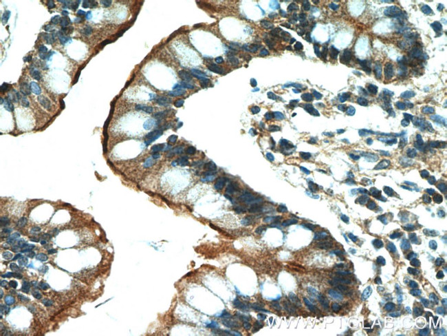 Villin Antibody in Immunohistochemistry (Paraffin) (IHC (P))