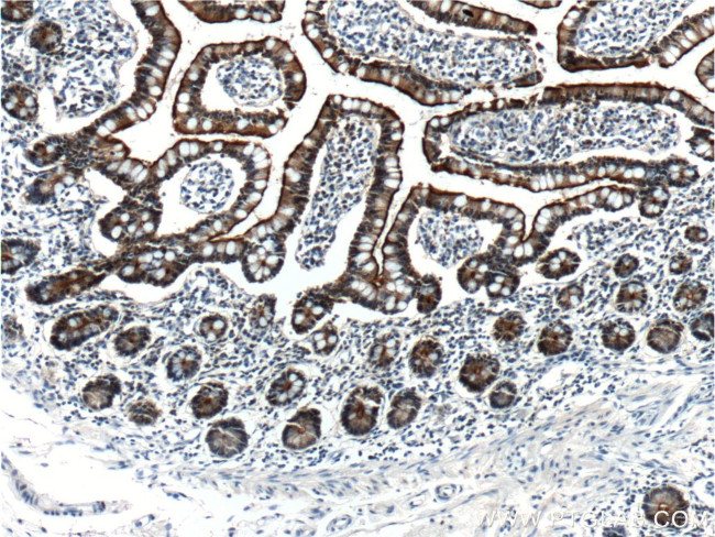 Villin Antibody in Immunohistochemistry (Paraffin) (IHC (P))