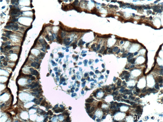 Villin Antibody in Immunohistochemistry (Paraffin) (IHC (P))