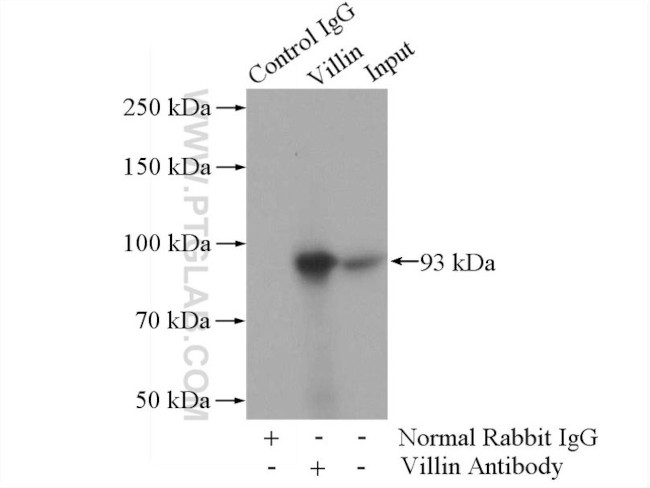 Villin Antibody in Immunoprecipitation (IP)