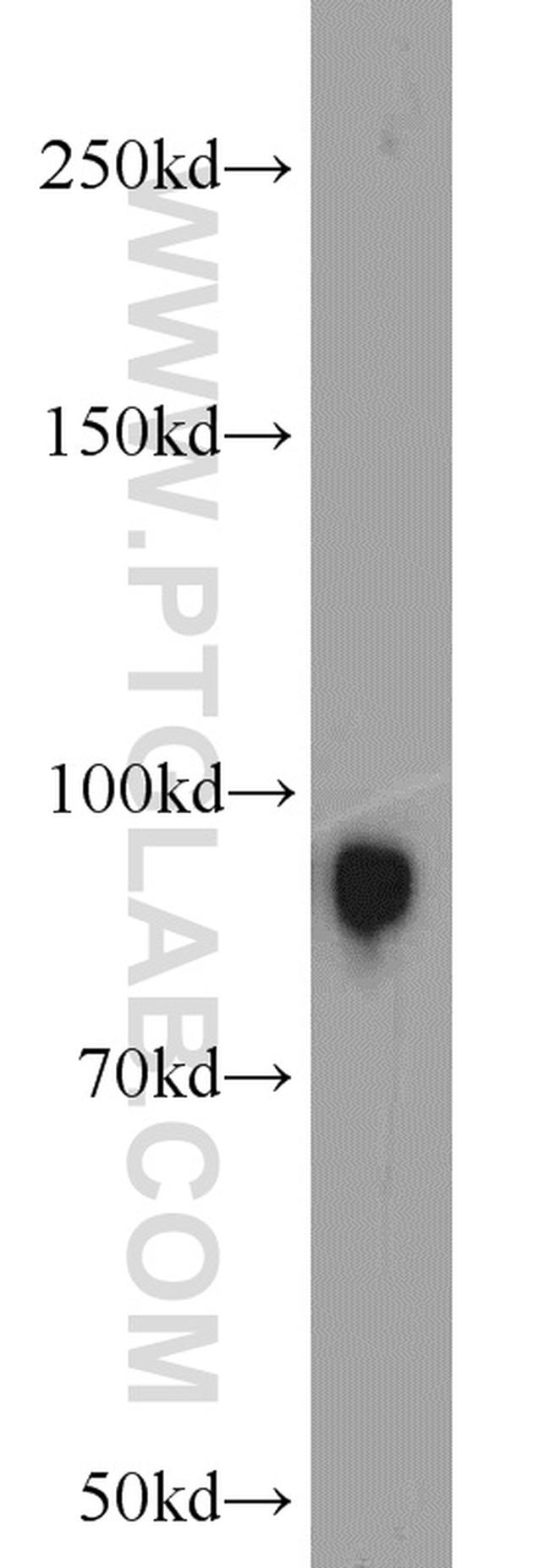 Villin Antibody in Western Blot (WB)