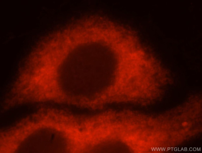 RPS12 Antibody in Immunocytochemistry (ICC/IF)