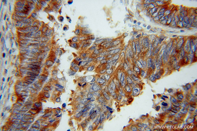 RPS12 Antibody in Immunohistochemistry (Paraffin) (IHC (P))