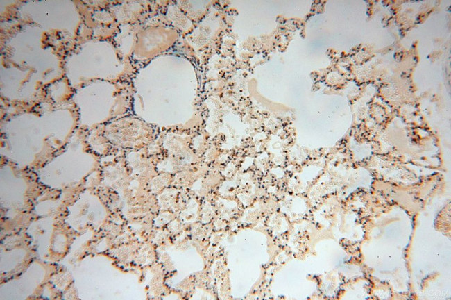 Moesin Antibody in Immunohistochemistry (Paraffin) (IHC (P))