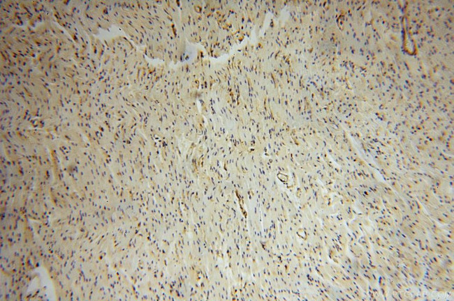 Moesin Antibody in Immunohistochemistry (Paraffin) (IHC (P))