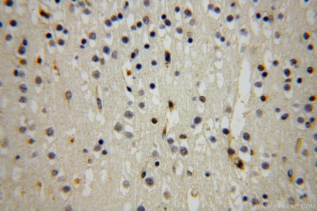 Moesin Antibody in Immunohistochemistry (Paraffin) (IHC (P))