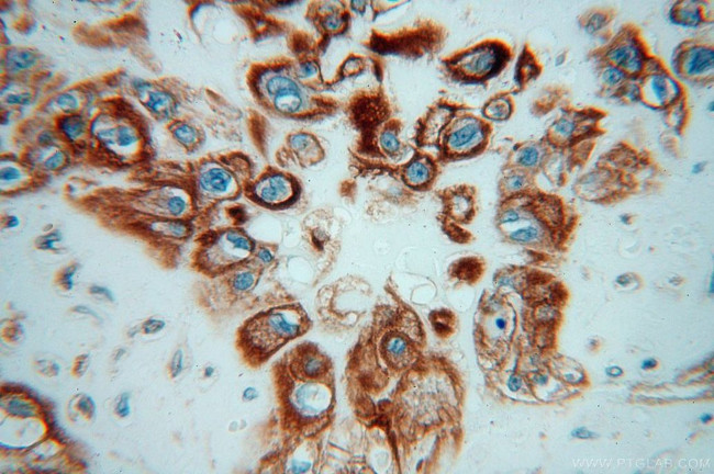 Moesin Antibody in Immunohistochemistry (Paraffin) (IHC (P))