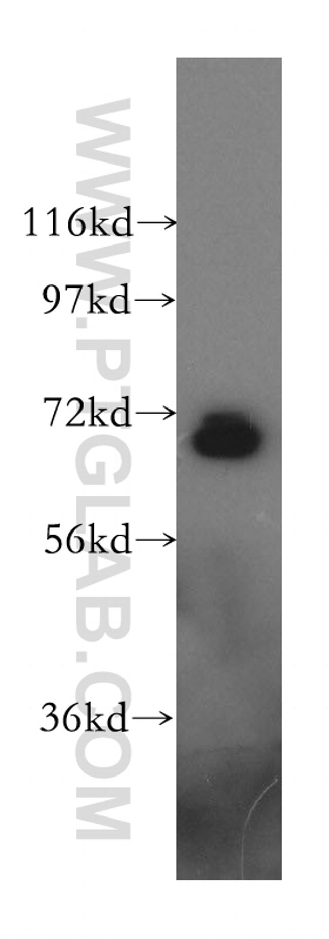 Moesin Antibody in Western Blot (WB)