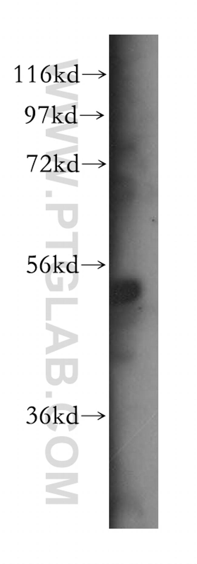 SDCCAG10 Antibody in Western Blot (WB)