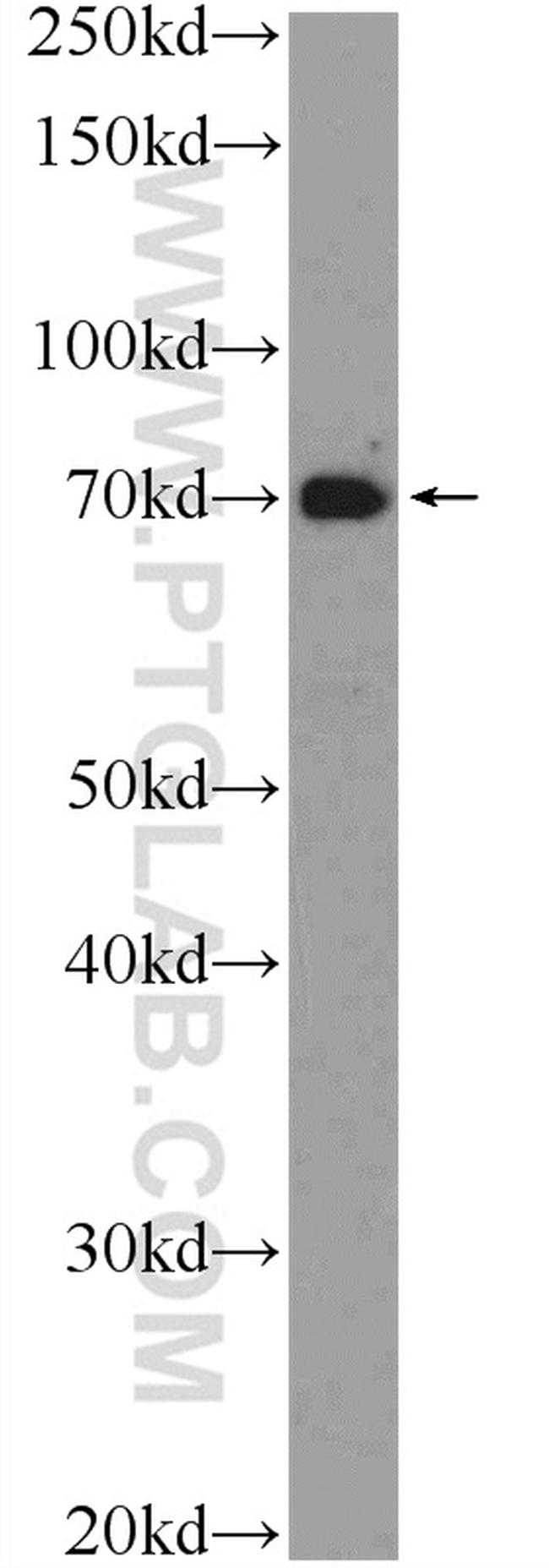 WDR48 Antibody in Western Blot (WB)