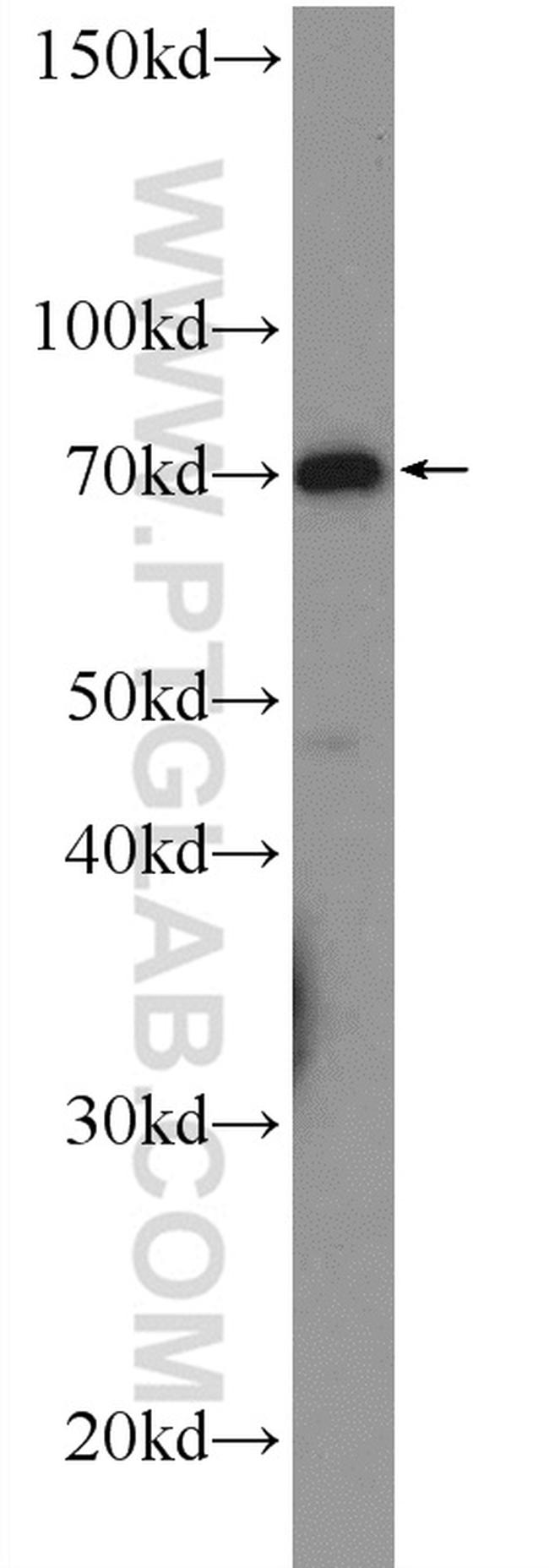 WDR48 Antibody in Western Blot (WB)