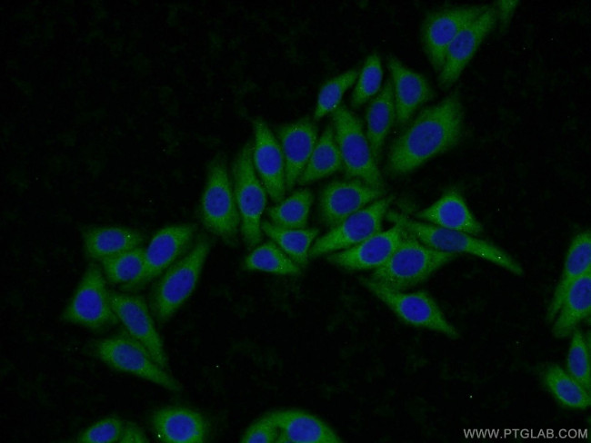 ARH3 Antibody in Immunocytochemistry (ICC/IF)