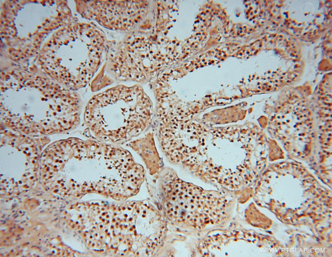 ARH3 Antibody in Immunohistochemistry (Paraffin) (IHC (P))