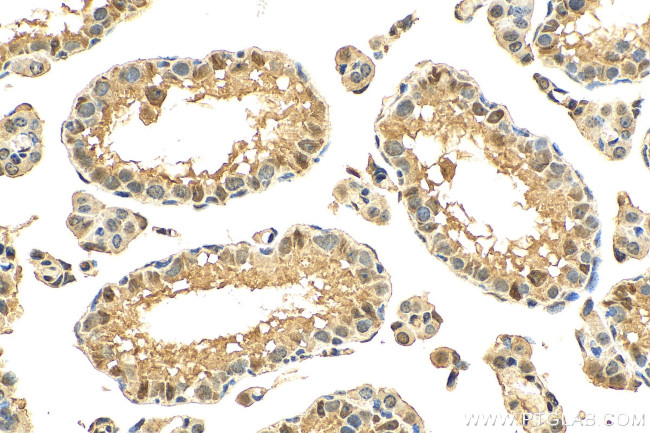 ARH3 Antibody in Immunohistochemistry (Paraffin) (IHC (P))