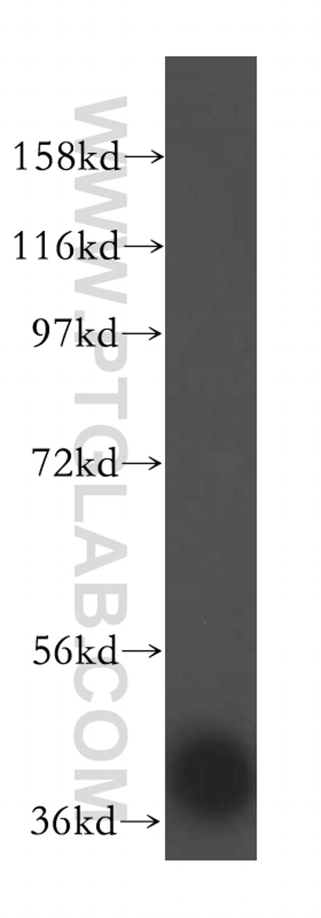 ARH3 Antibody in Western Blot (WB)