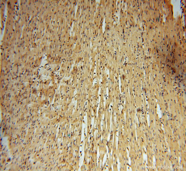 ARH3 Antibody in Immunohistochemistry (Paraffin) (IHC (P))