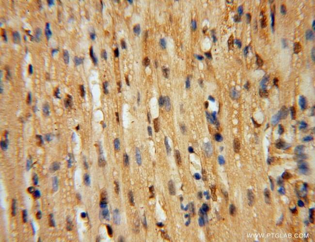 ARH3 Antibody in Immunohistochemistry (Paraffin) (IHC (P))