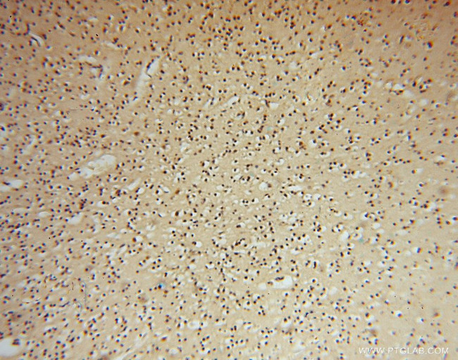 ARH3 Antibody in Immunohistochemistry (Paraffin) (IHC (P))