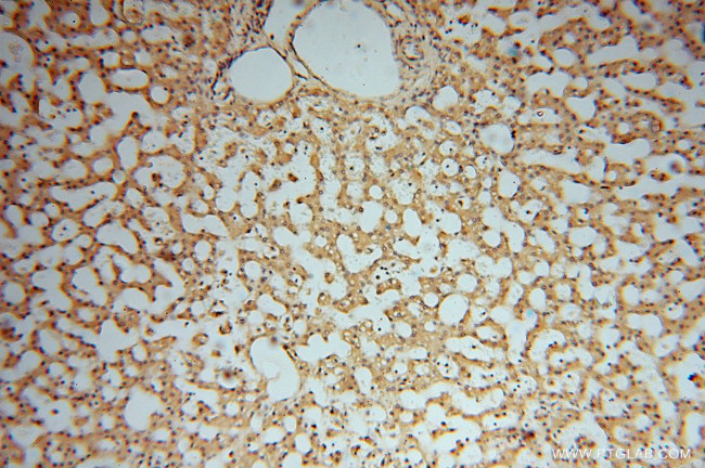 ARH3 Antibody in Immunohistochemistry (Paraffin) (IHC (P))