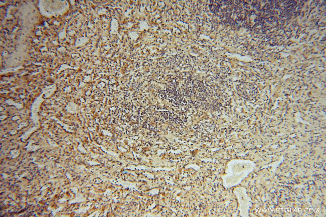 ARH3 Antibody in Immunohistochemistry (Paraffin) (IHC (P))