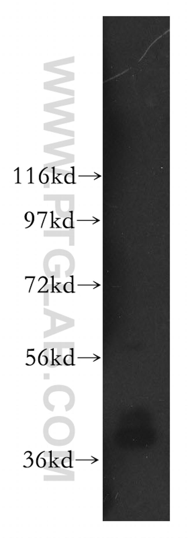 ARH3 Antibody in Western Blot (WB)