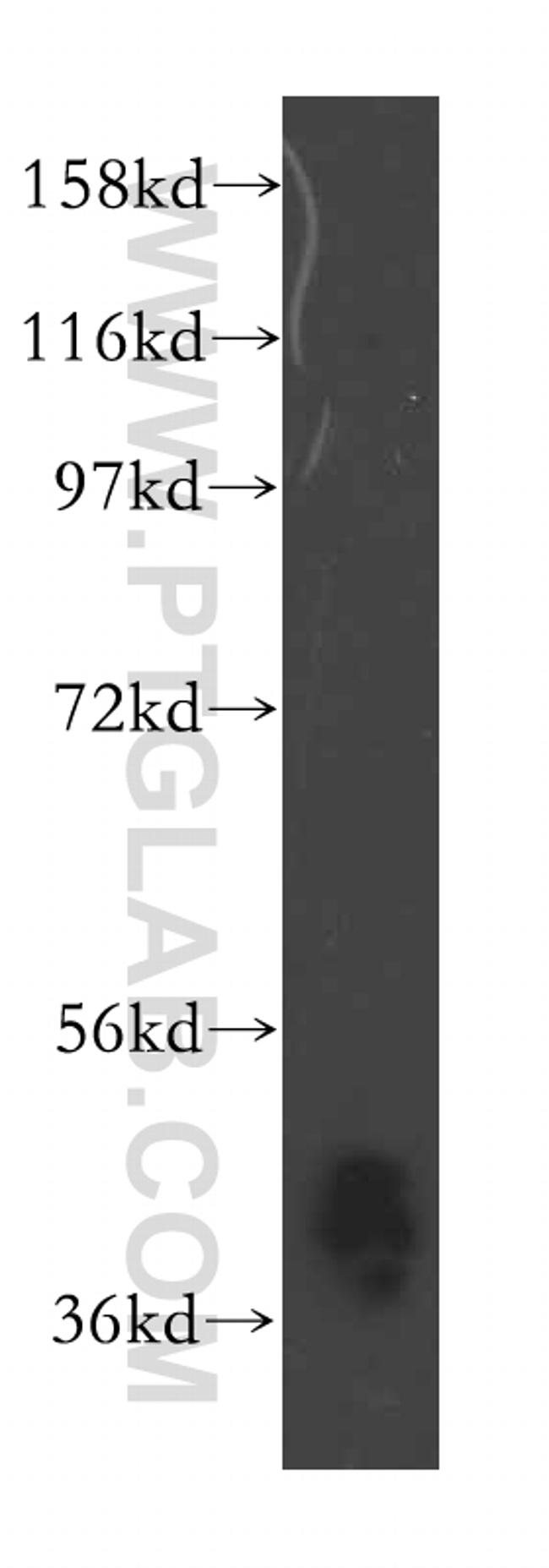 ARH3 Antibody in Western Blot (WB)