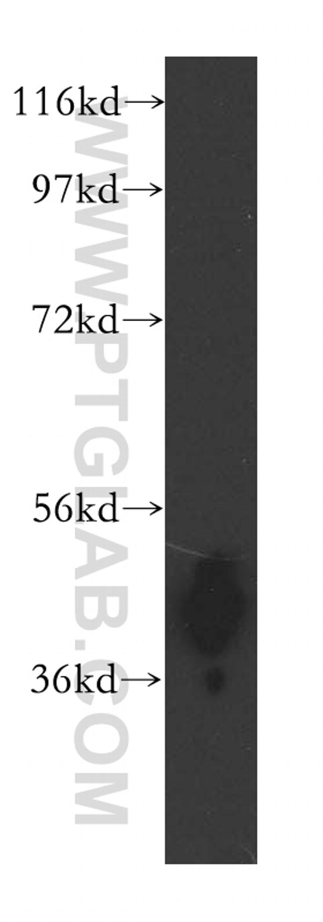 ARH3 Antibody in Western Blot (WB)