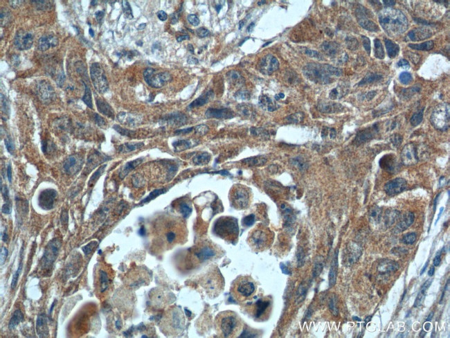 ODAM Antibody in Immunohistochemistry (Paraffin) (IHC (P))