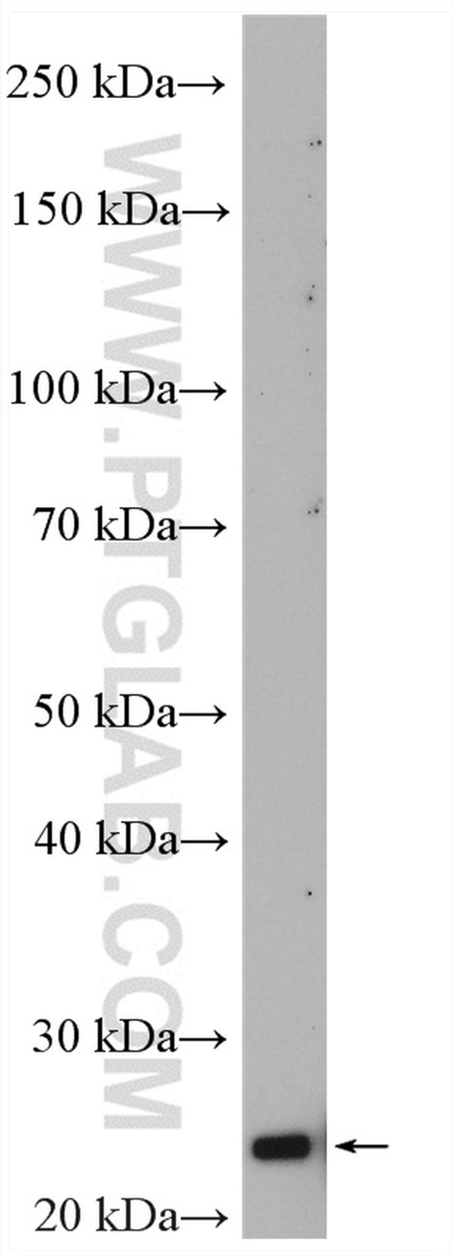 DUSP22 Antibody in Western Blot (WB)