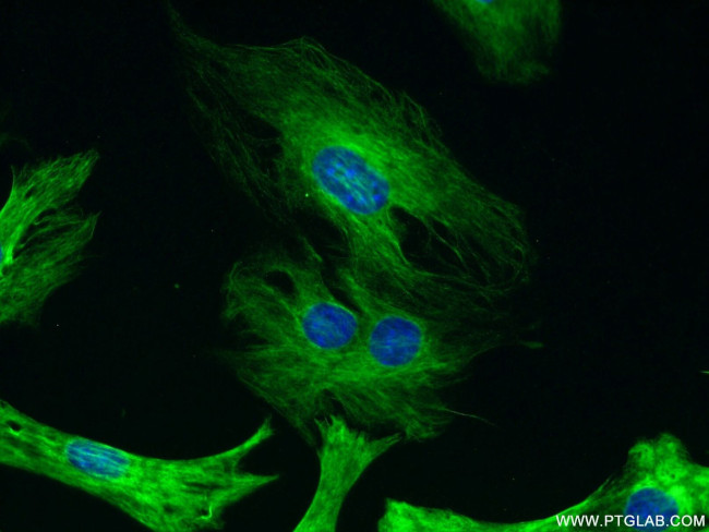 Desmin Antibody in Immunocytochemistry (ICC/IF)