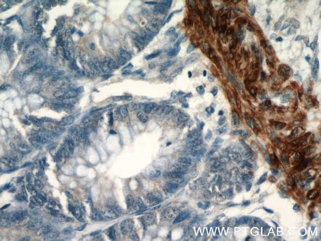 Desmin Antibody in Immunohistochemistry (Paraffin) (IHC (P))