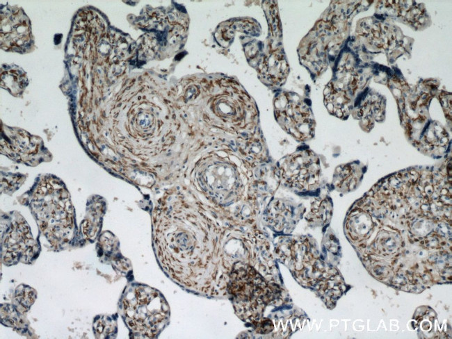 Desmin Antibody in Immunohistochemistry (Paraffin) (IHC (P))