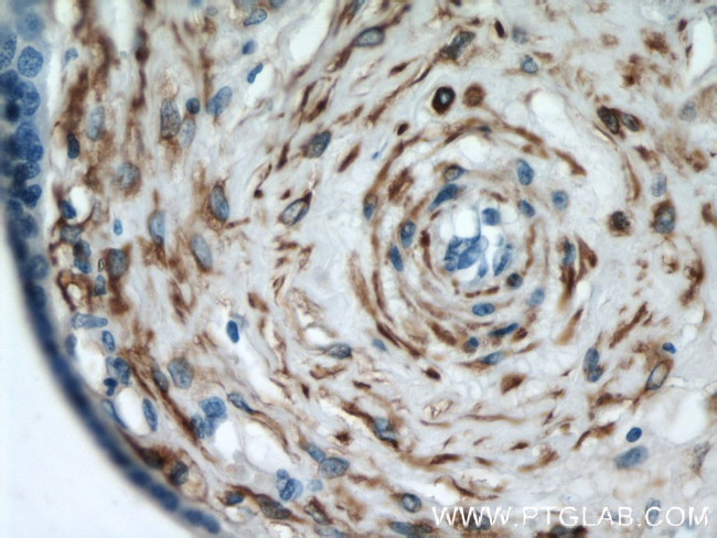 Desmin Antibody in Immunohistochemistry (Paraffin) (IHC (P))