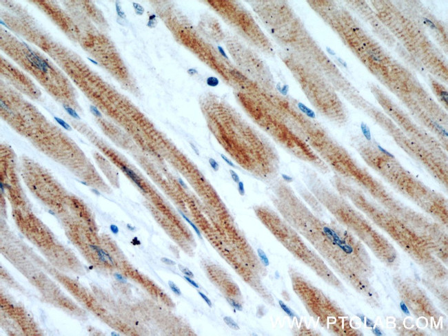 Desmin Antibody in Immunohistochemistry (Paraffin) (IHC (P))