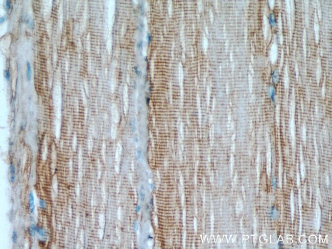 Desmin Antibody in Immunohistochemistry (Paraffin) (IHC (P))