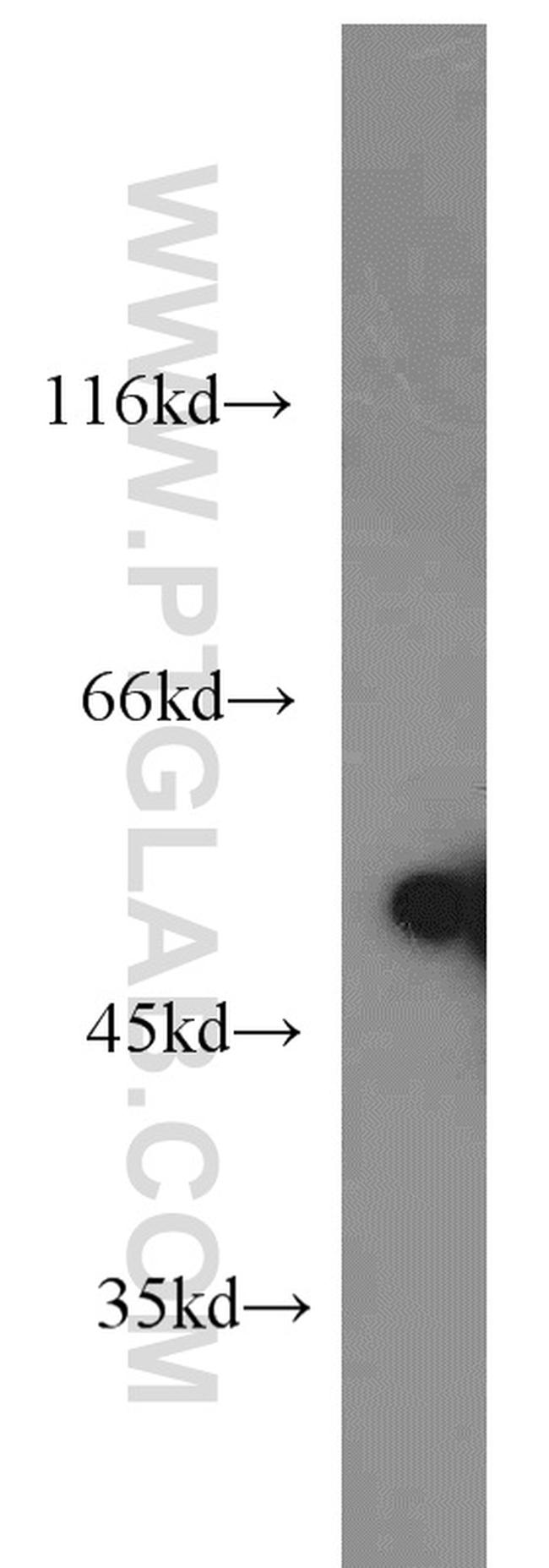 Desmin Antibody in Western Blot (WB)