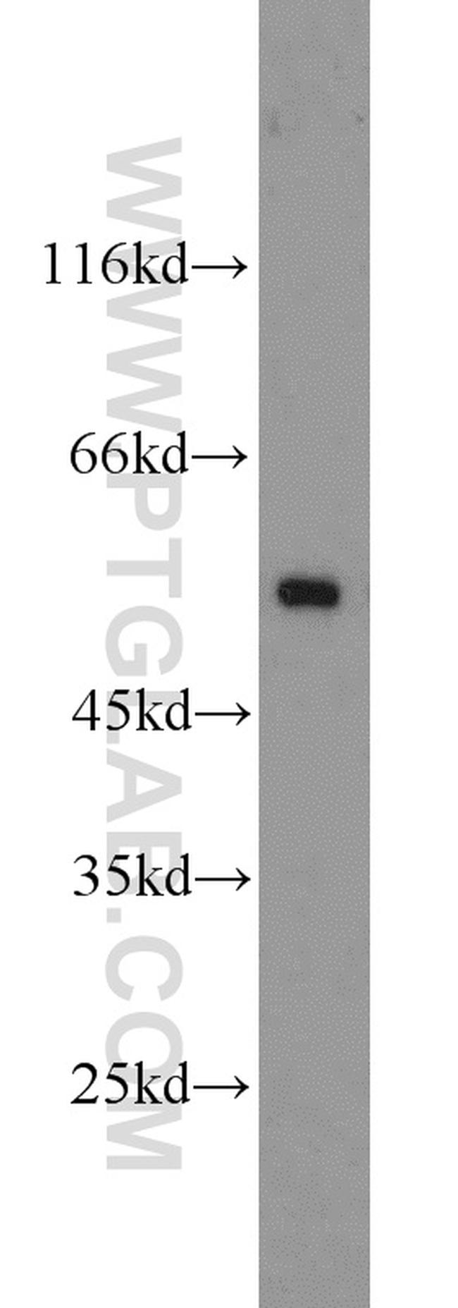 Desmin Antibody in Western Blot (WB)