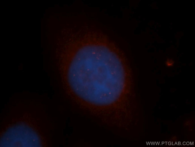 NGDN Antibody in Immunocytochemistry (ICC/IF)