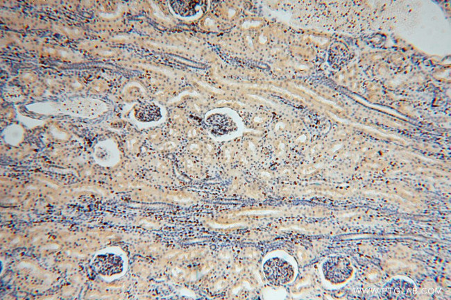 NGDN Antibody in Immunohistochemistry (Paraffin) (IHC (P))