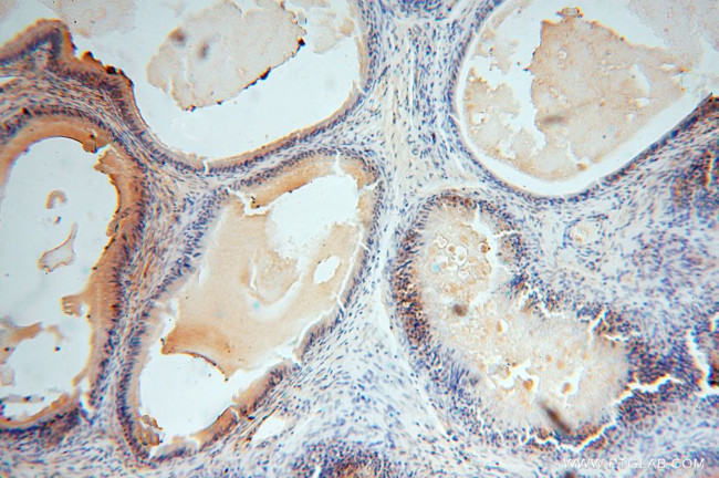 NGDN Antibody in Immunohistochemistry (Paraffin) (IHC (P))