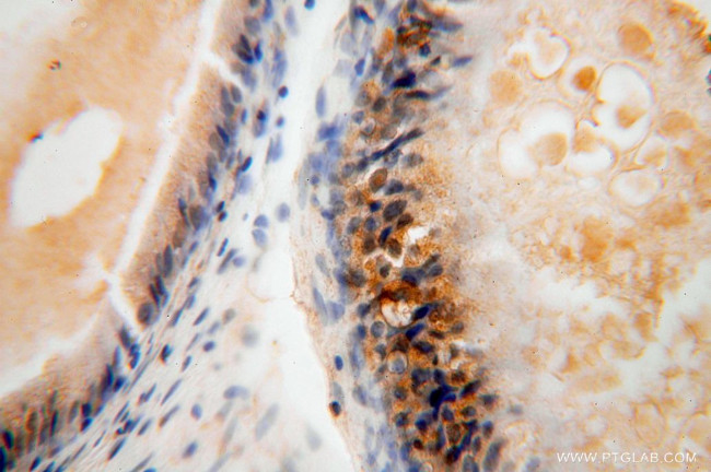 NGDN Antibody in Immunohistochemistry (Paraffin) (IHC (P))