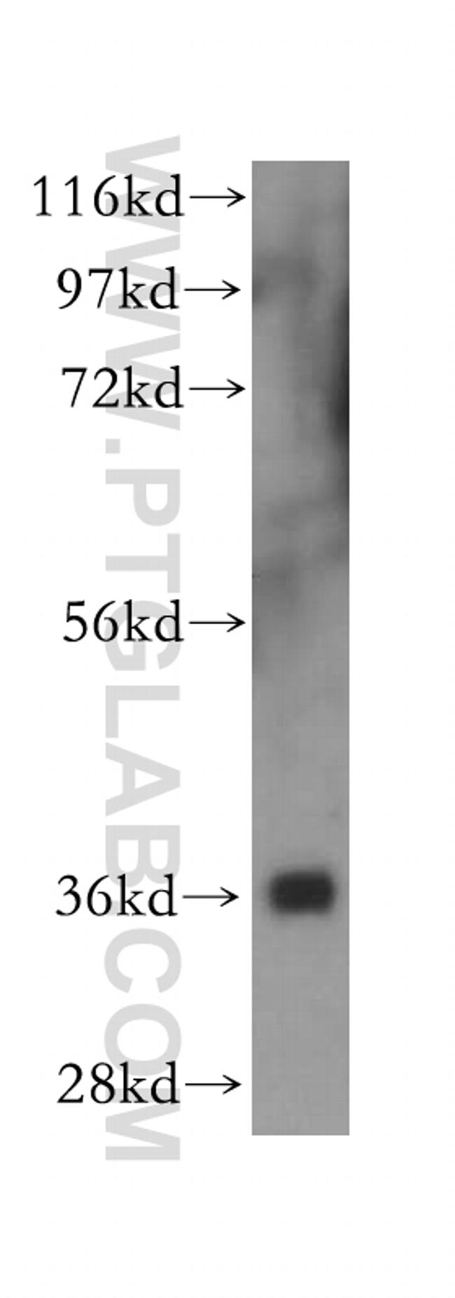 NGDN Antibody in Western Blot (WB)