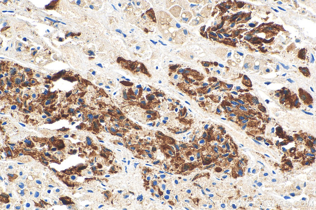 Prolactin Antibody in Immunohistochemistry (Paraffin) (IHC (P))