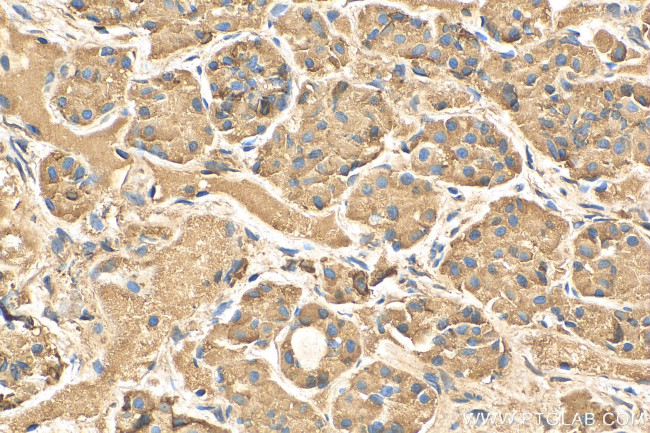 Prolactin Antibody in Immunohistochemistry (Paraffin) (IHC (P))